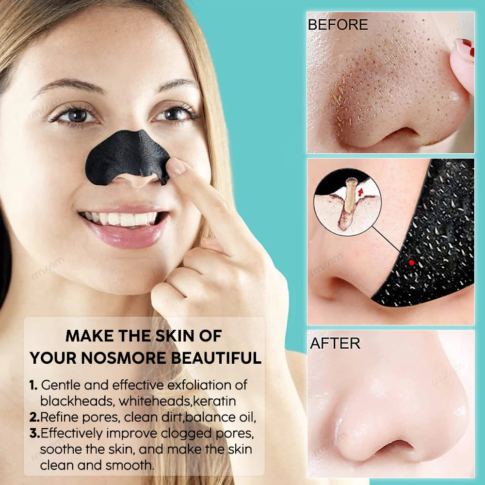 Unisex Blackhead Remove Mask Peel Nasal Strips Deep Shrink Cleansing